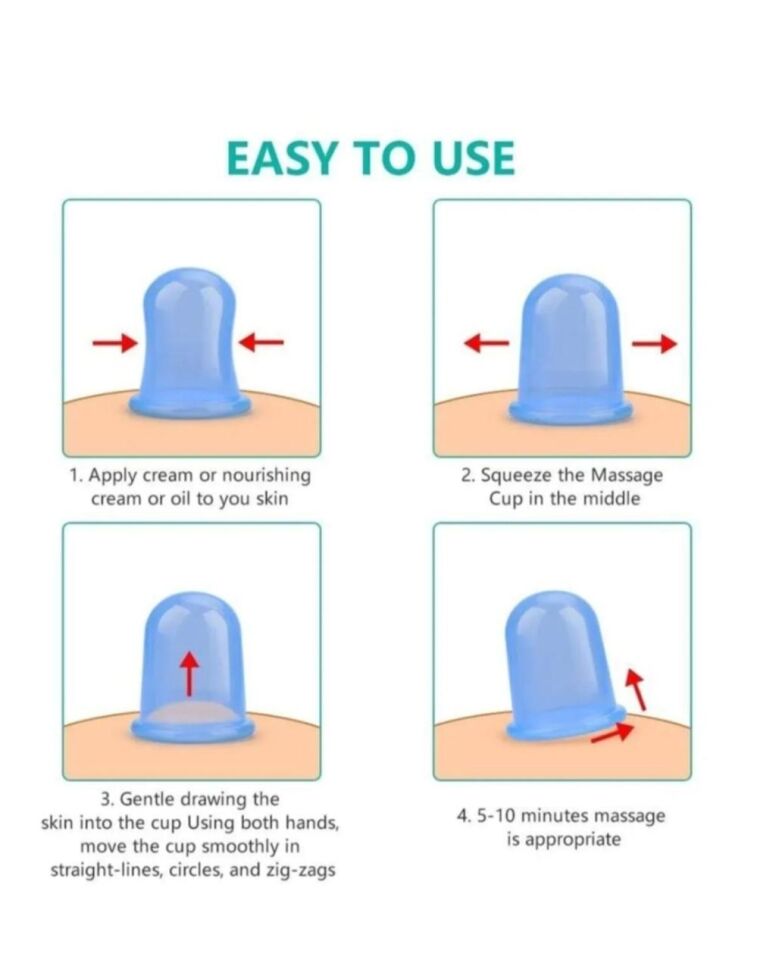 PVS MASAJ KUPASI NRD 1288